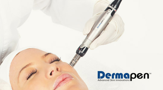 DERMAPEN MICRONEEDLING KOLLAGEENTERAAPIA